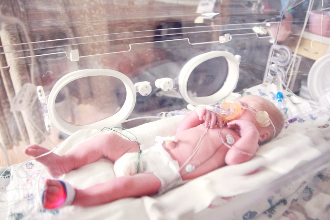 A newborn baby lying in a neonatal incubator receiving medical care. The baby is connected to monitoring devices with sensors attached to its body and is wearing a diaper and a pacifier.